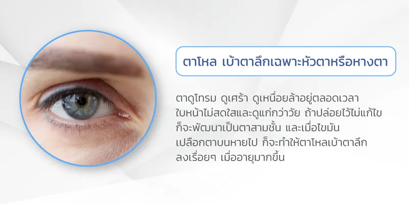 ลักษณะตาโหล-3