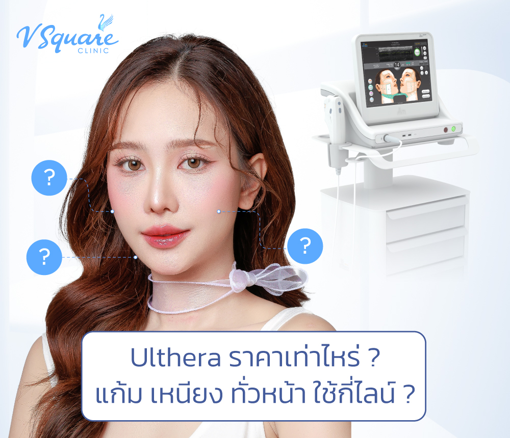 Ulthera ราคา