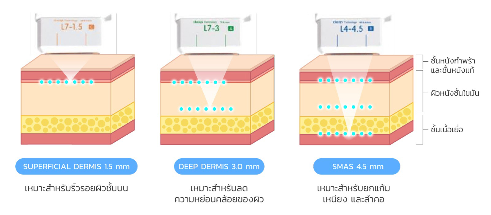 ระดับชั้นผิว