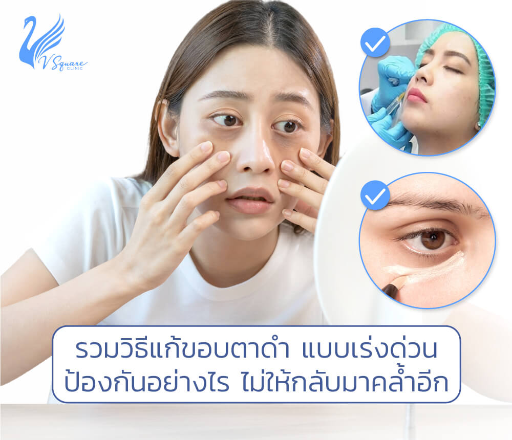 วิธีแก้ขอบตาดําเร่งด่วน วิธีไหนเห็นผล ป้องกันอย่างไร ไม่ให้กลับมาคล้ำอีก วิธีแก้ขอบตาดําเร่งด่วน วิธีไหนเห็นผล ป้องกันอย่างไร ไม่ให้กลับมาคล้ำอีก