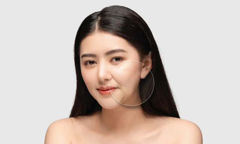 หน้าเด็กได้ 20 วิธีที่แพทย์แนะนำ และสาเหตุที่ทำให้หน้าแก่ก่อนวัยที่ควรรู้ หน้าเด็กได้ 20 วิธีที่แพทย์แนะนำ และสาเหตุที่ทำให้หน้าแก่ก่อนวัยที่ควรรู้