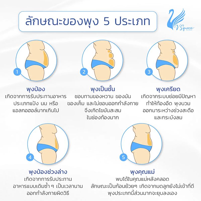 10 วิธีลดพุงใน 3 วัน 7 วัน 1 เดือน 2 เดือน วิธีไหน? พุงยุบเร่งด่วน 10 วิธีลดพุงใน 3 วัน 7 วัน 1 เดือน 2 เดือน วิธีไหน? พุงยุบเร่งด่วน