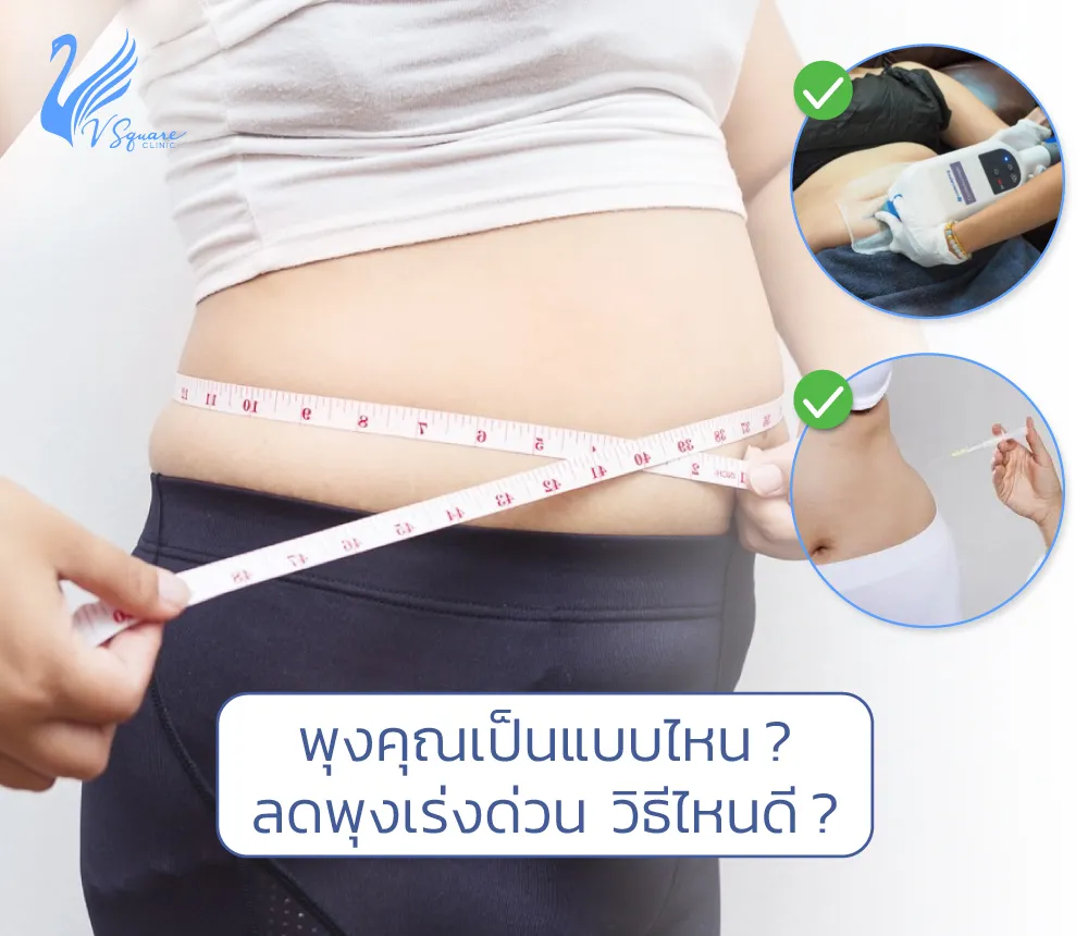 10 วิธีลดพุงใน 3 วัน 7 วัน 1 เดือน 2 เดือน วิธีไหน? พุงยุบเร่งด่วน