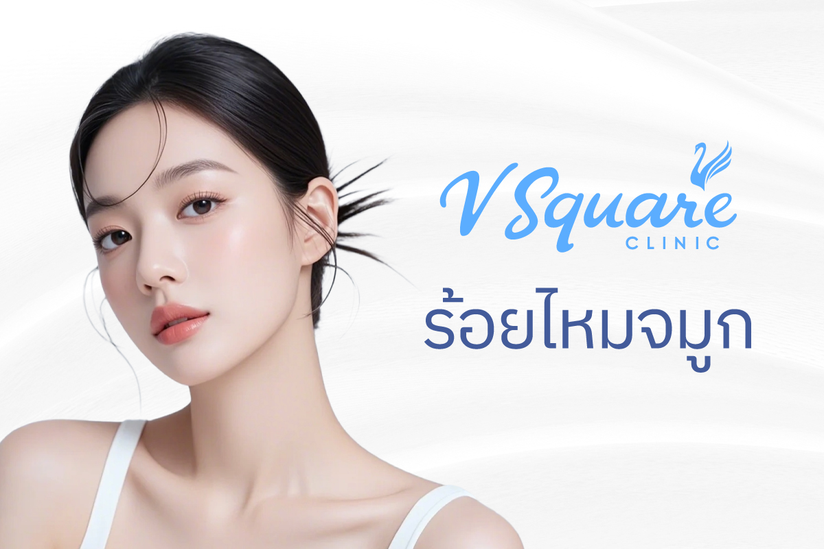 ร้อยไหมจมูกราคาเริ่มต้น