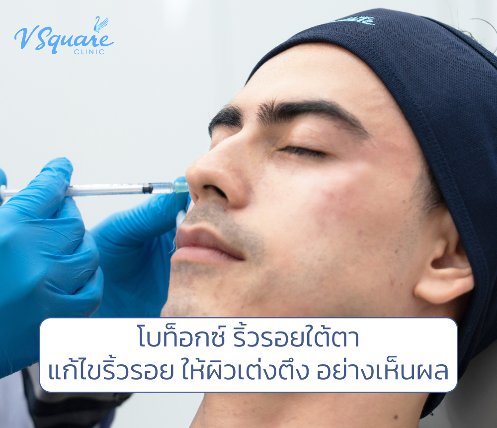 รูปบทความ_โบท็อกซ์ริ้วรอยใต้ตา