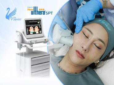 ทำอัลเทอร่า-(Ulthera-SPT)-เจ็บหรือไม่-370x277
