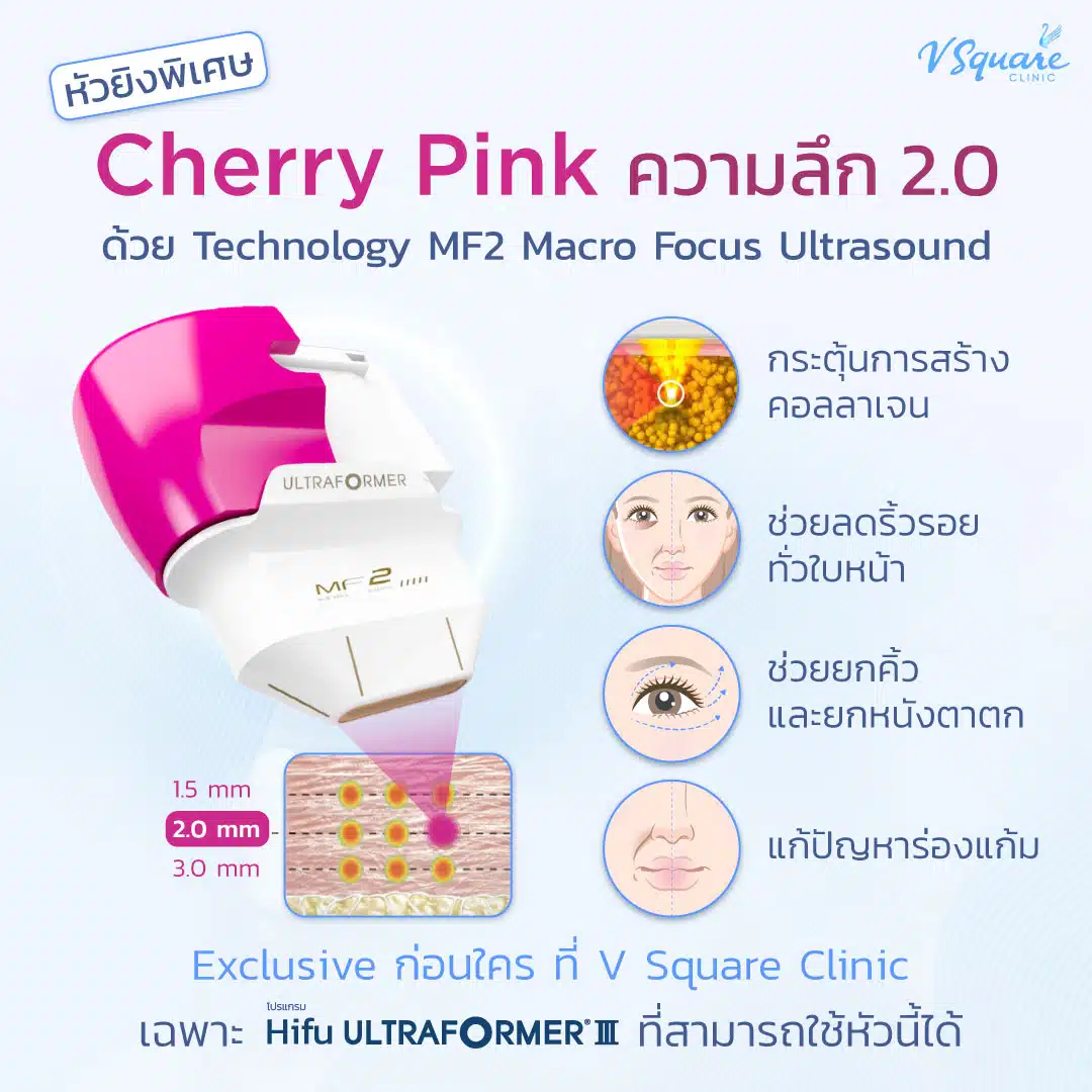 หัวพิเศษ Hifu Cherry Pink
