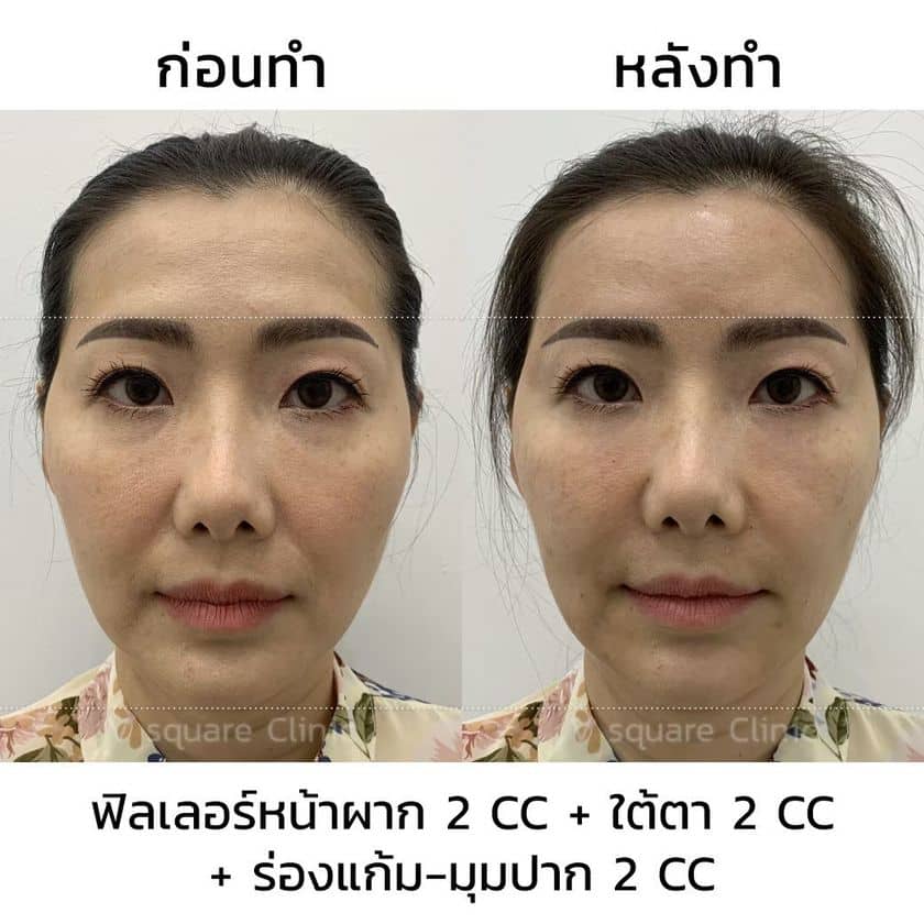 My Image 16