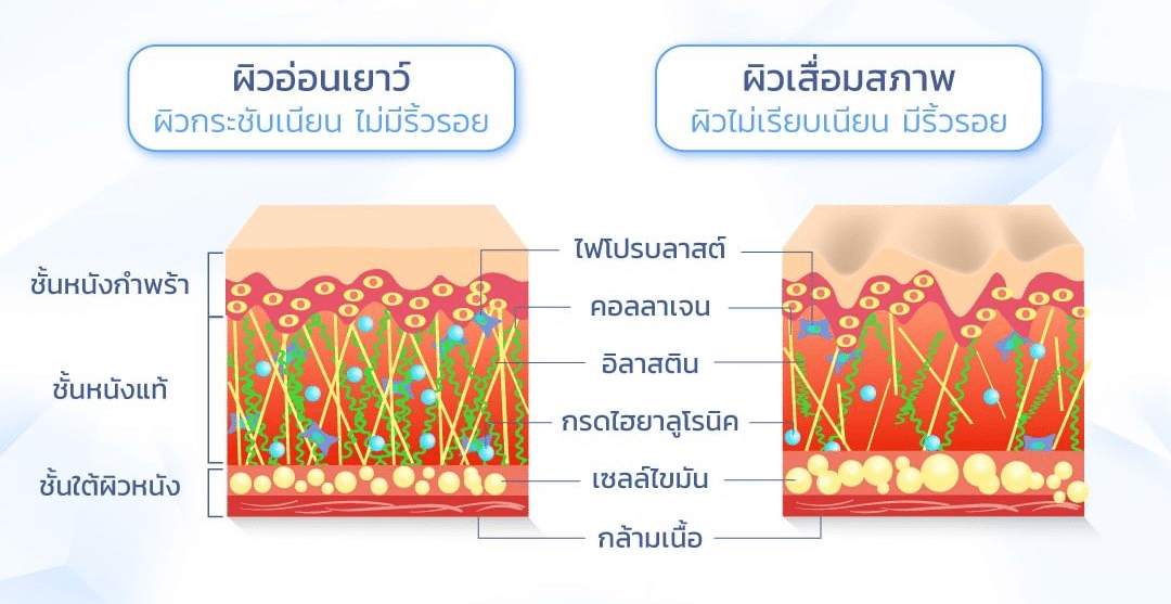 ผิวขาดไฮยาลูรอน