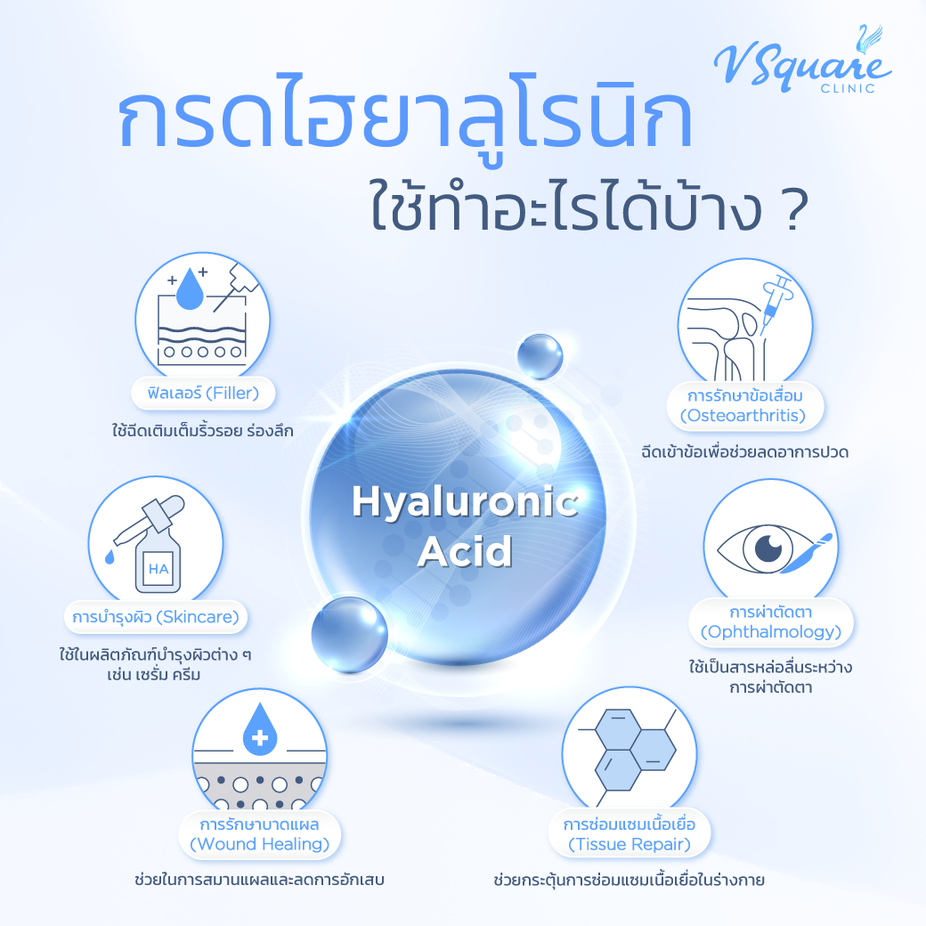 ไฮยาลูโรนิกสังเคราะห์