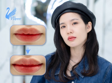 รีวิวปากกระจับ
