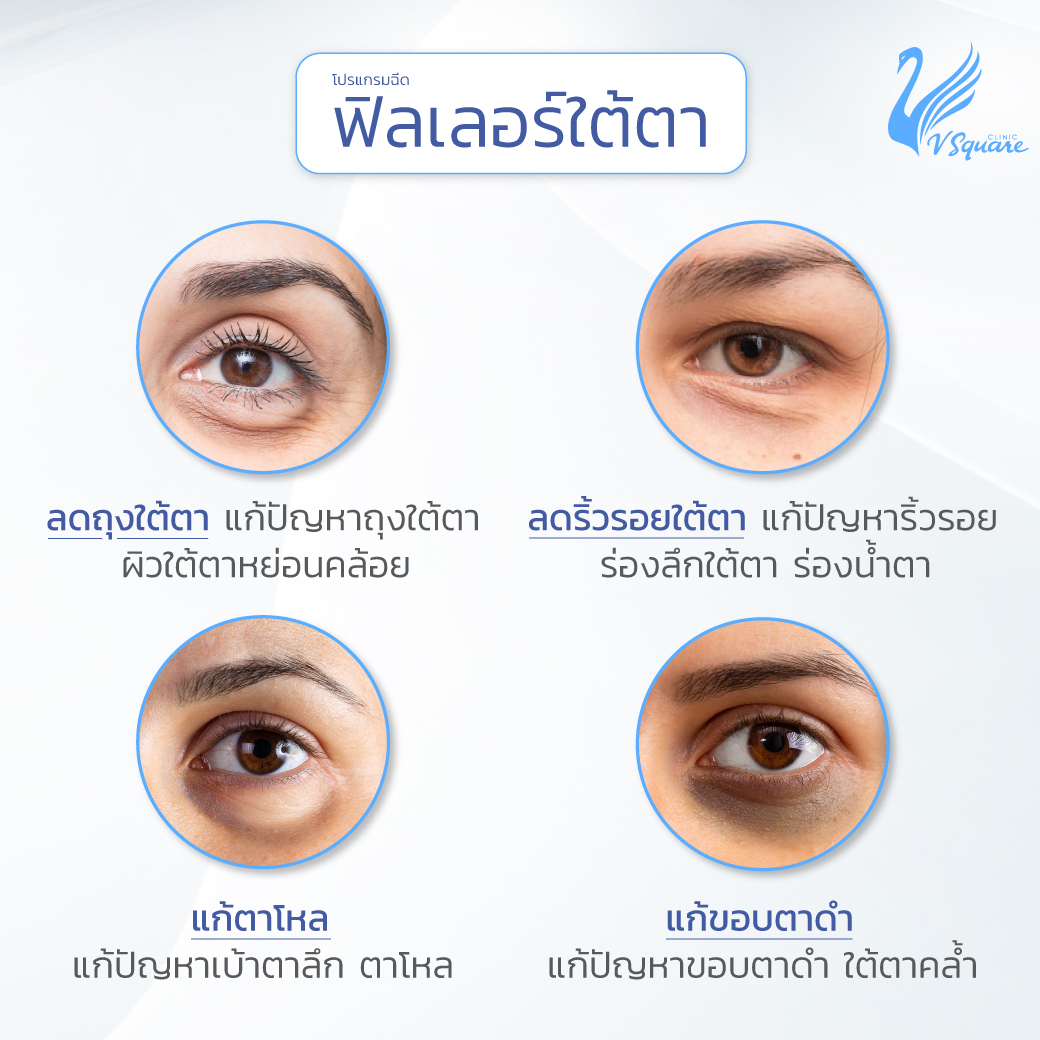 AW_โปรแกรมฉีดฟิลเลอร์ใต้ตา
