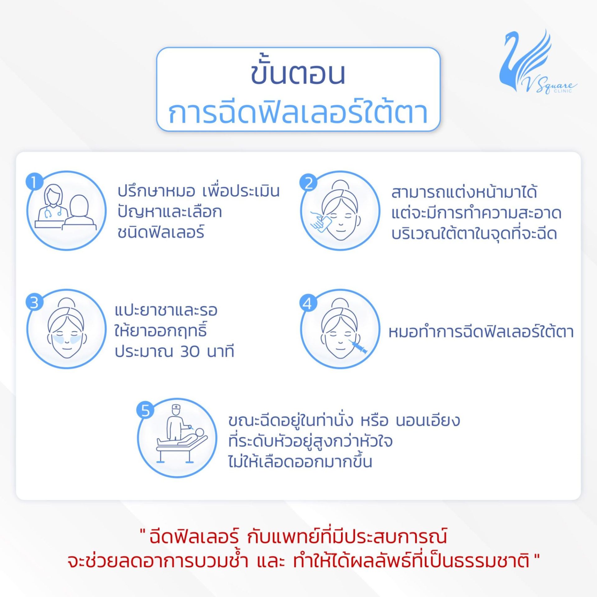 ขั้นตอนการเตรียมตัวก่อนฉีดฟิลเลอร์ใต้ตา