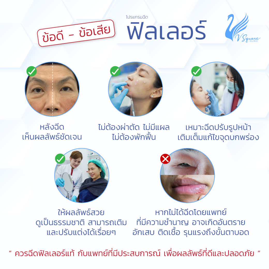 ฉีดฟิลเลอร์ใต้ตา ข้อดี - ข้อเสีย โดยหมอวา หมอปุ๋ย