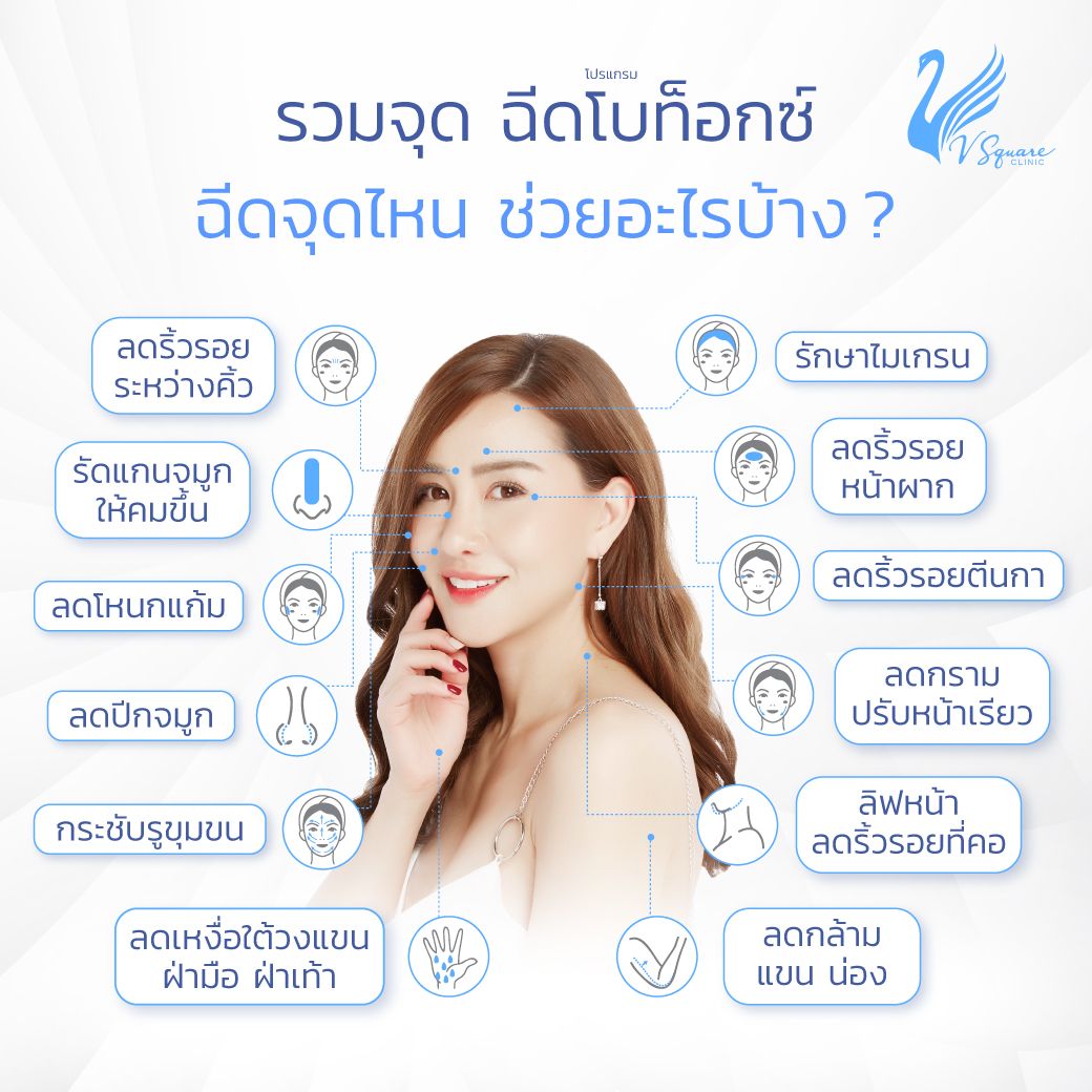 ฉีดโบท็อก ได้บริเวณไหนบ้าง คุณนิโคล
