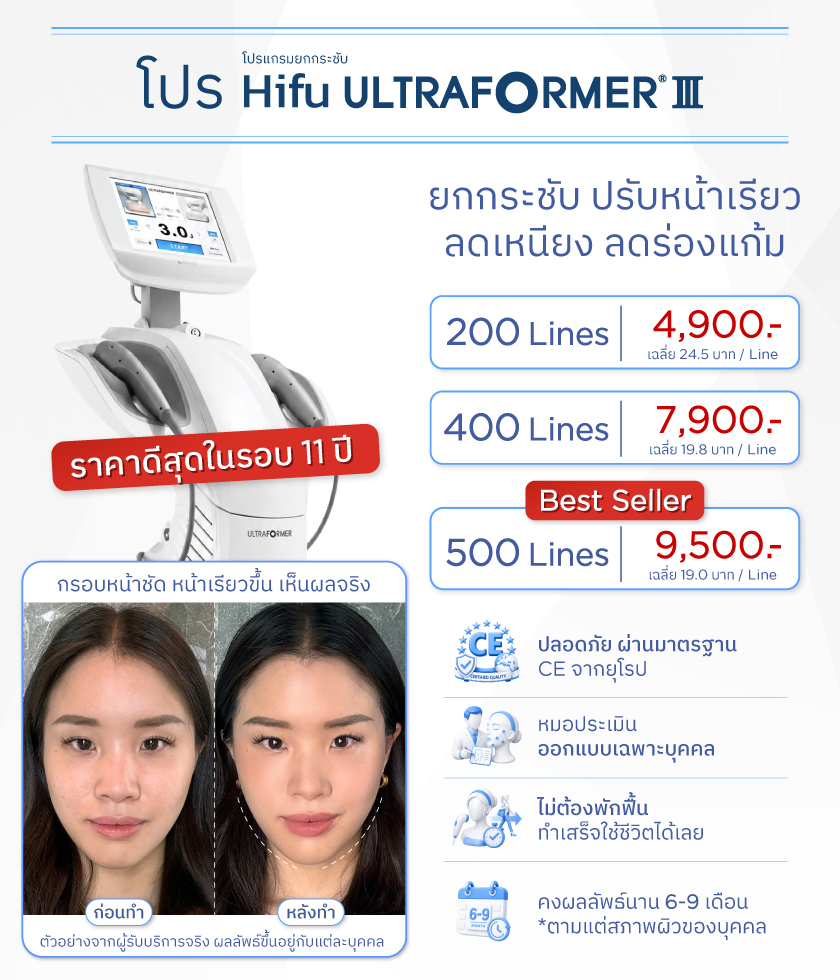Ultraformer III ราคา