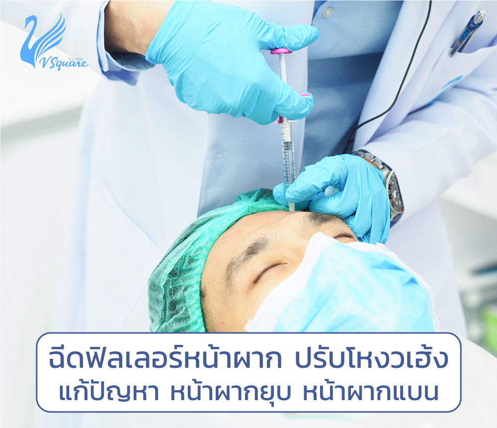 ฉีดฟิลเลอร์หน้าผาก
