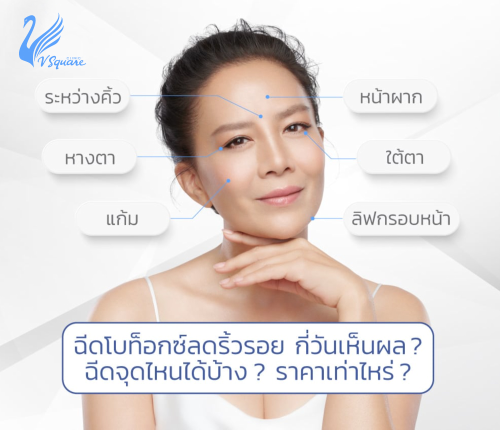 ฉีดโบลดริ้วรอย กี่วันเห็นผล