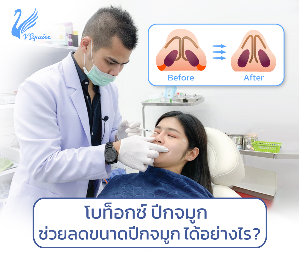 โบท็อกซ์ปีกจมูก โดย หมอกอล์ฟ