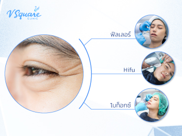 ฉีดโบท็อกใต้ตา คุณเจสซี่