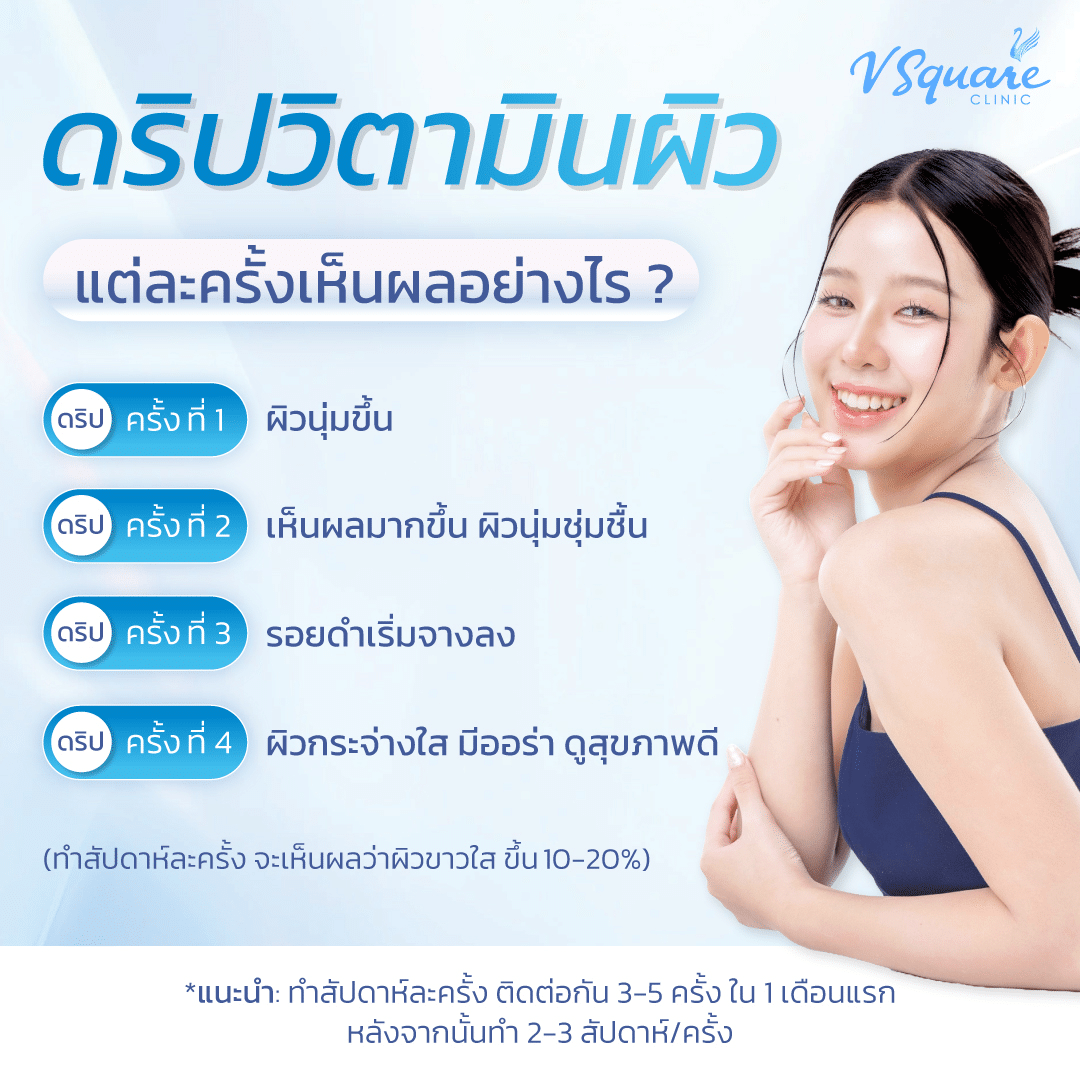ผลลัพธ์ดริปวิตามิน