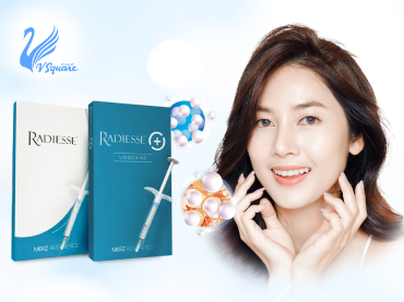 Radiesse filler