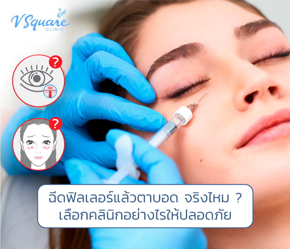 ฉีดฟิลเลอร์ตาบอด