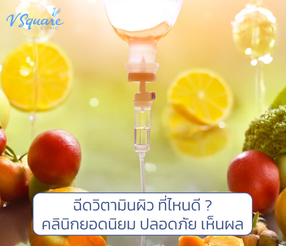 ฉีดวิตามินผิว ที่ไหนดี