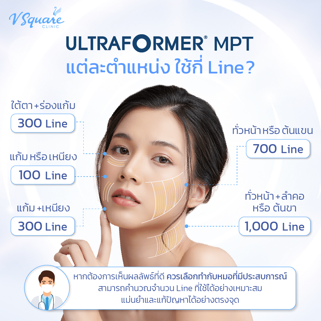 ทำ Ultraformer MPT ตำแหน่งไหน
