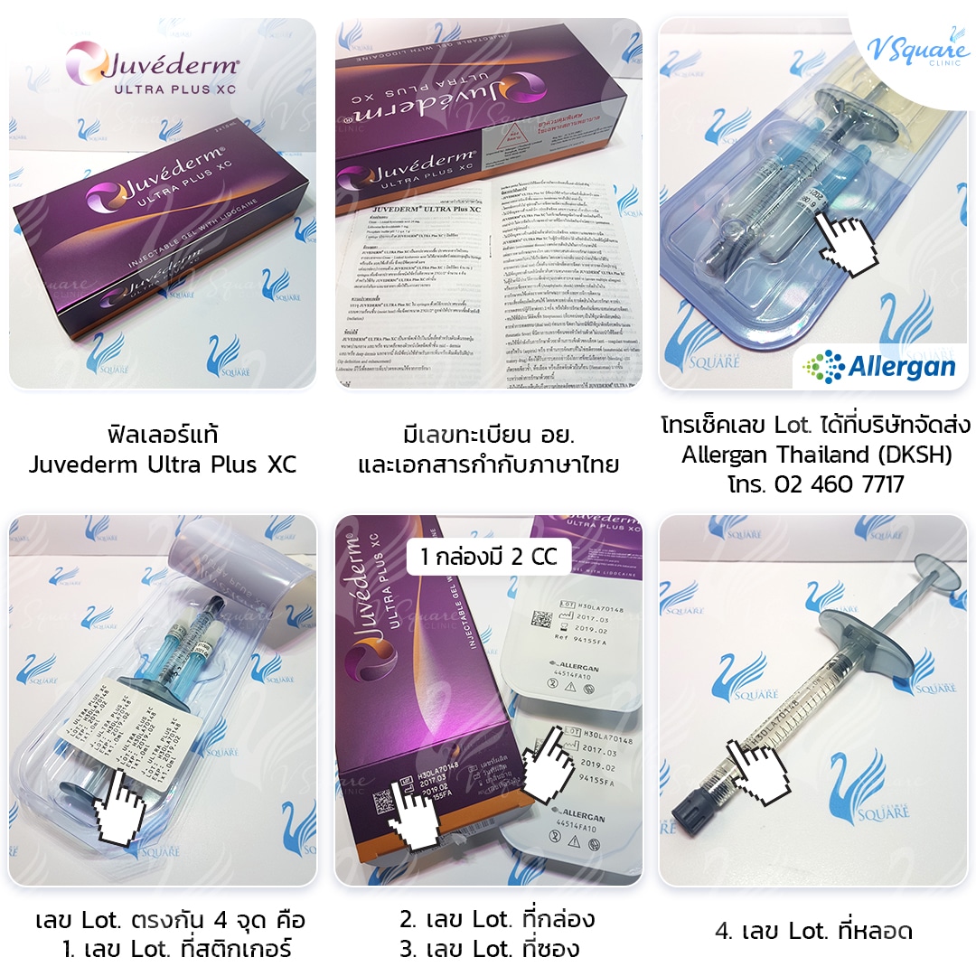 ธีดูฟิลเลอร์ยี่ห้อ Juvederm ของแท้