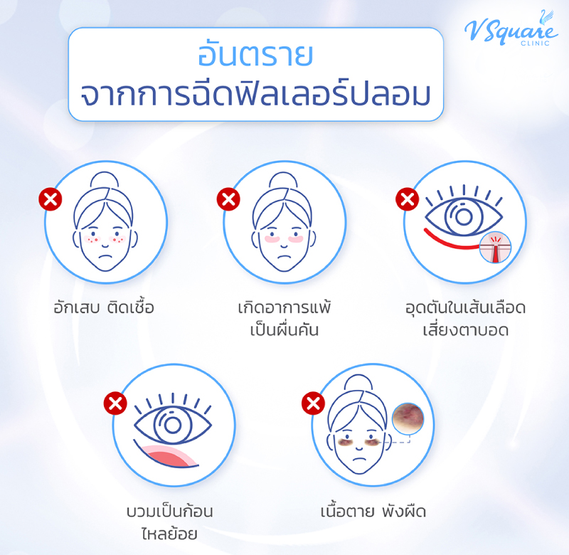 ผลข้างเคียงจากการฉีดฟิลเลอร์ปลอม