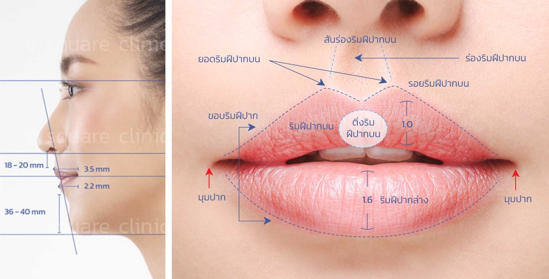 เลือกทรงปากอย่างไรให้เหมาะกับใบหน้า