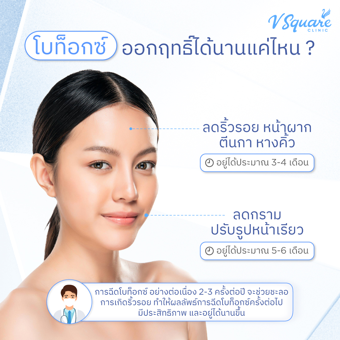 โบท็อกซ์ออกฤทธิ์ได้นานแค่ไหน