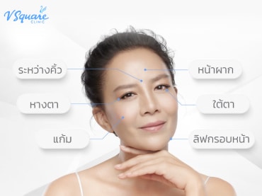 ฉีดโบท็อกซ์ลดริ้รอย-กี่วันเห็นผล-ฉีดจุดไหน โดย คุณต่าย