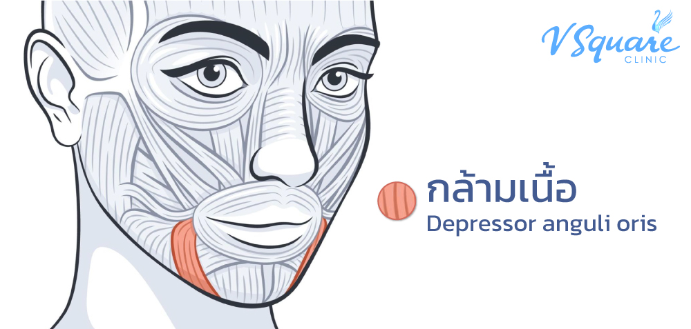 ตำแหน่งฉีดโบท็อกซ์ยกมุมปาก
