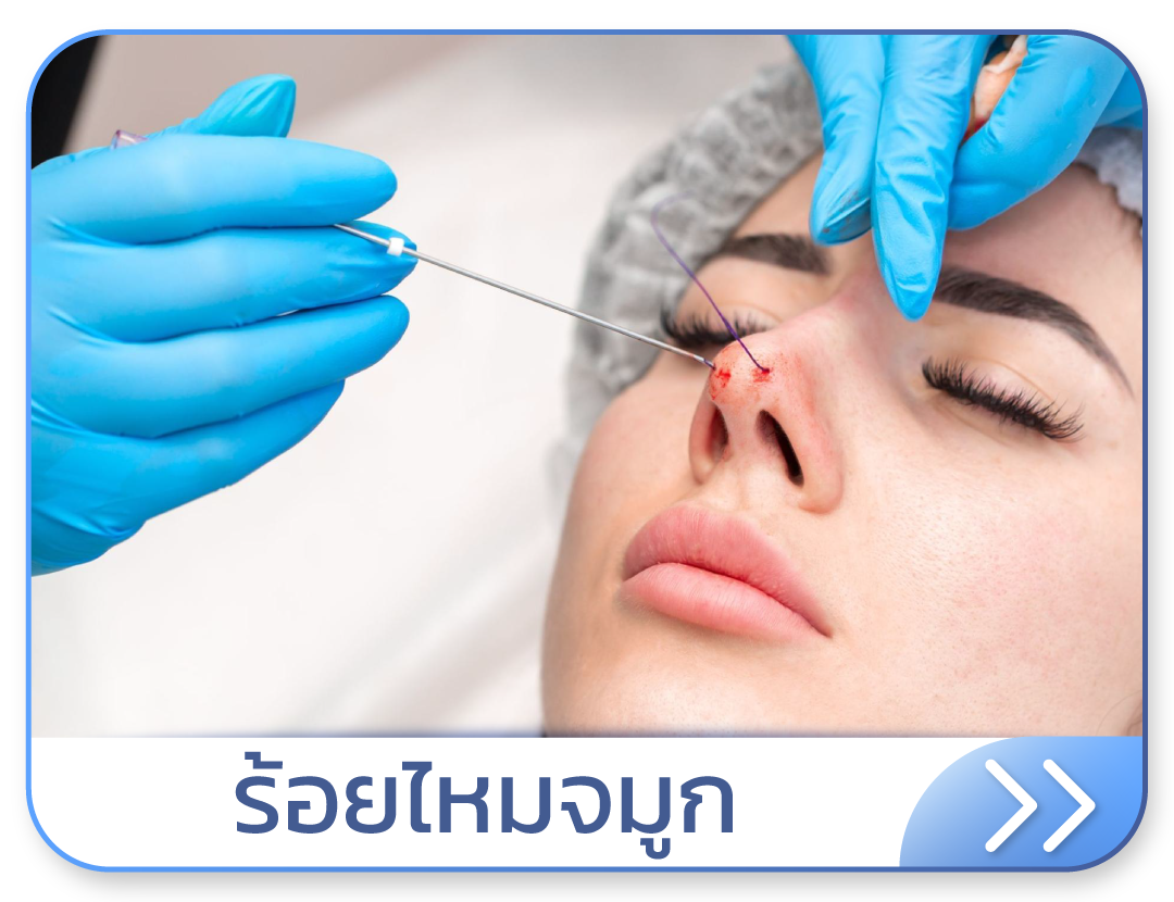 ร้อยไหมจมูก