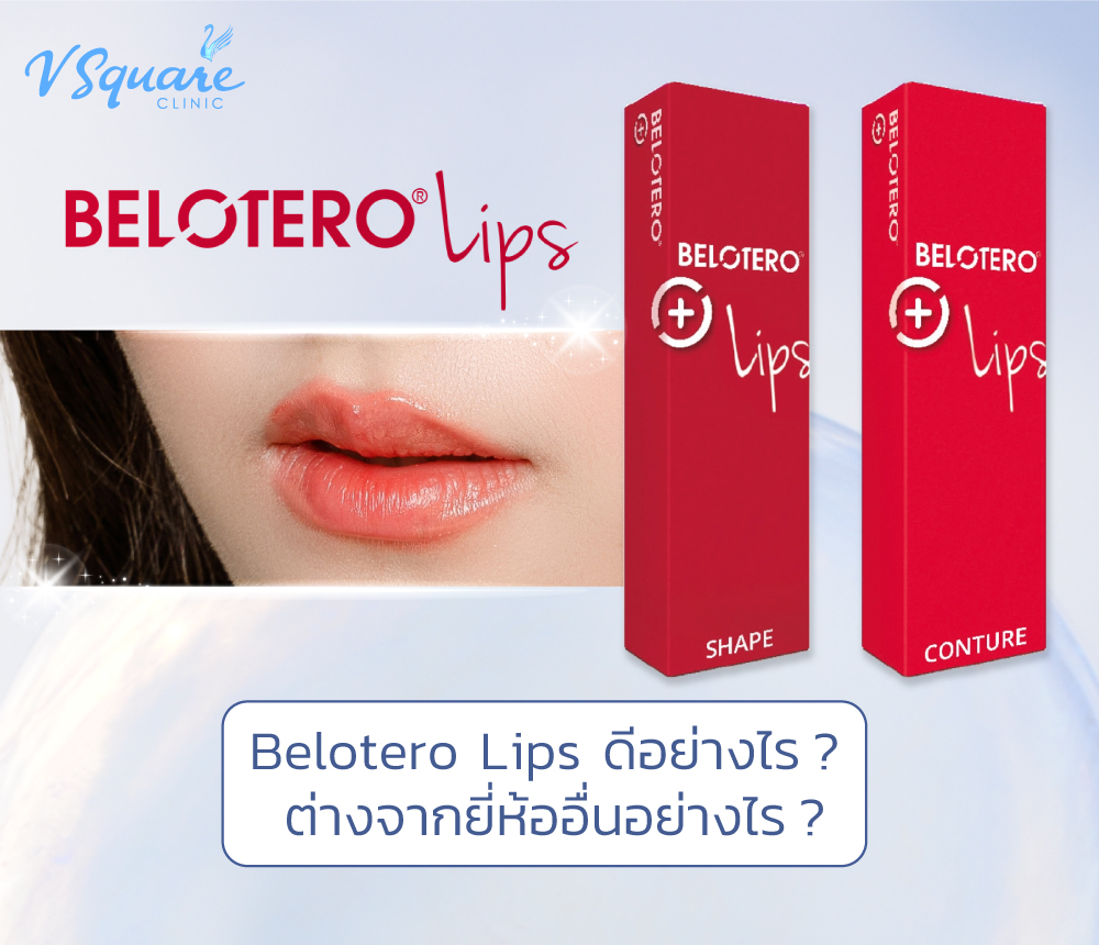 Belotero Lips