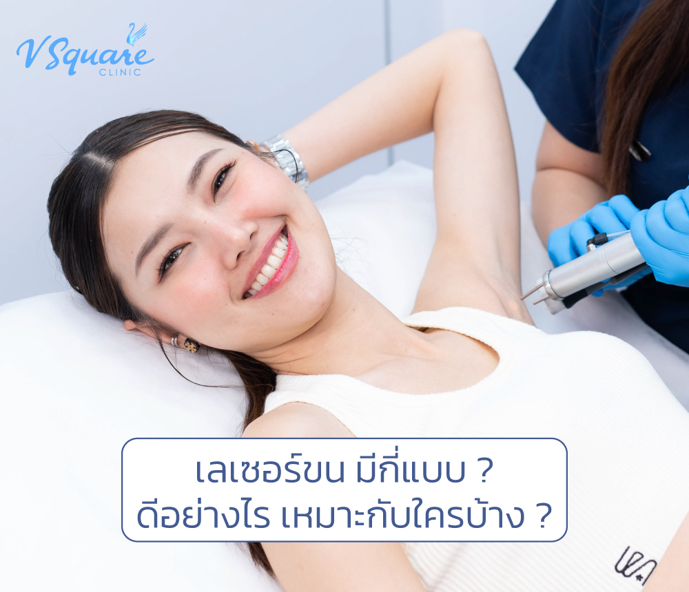 เลเซอร์ขน
