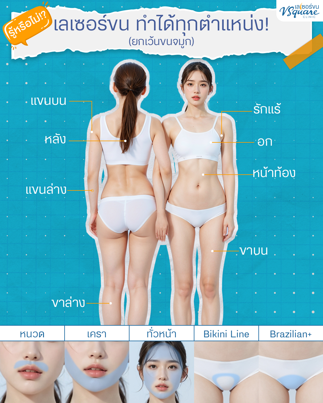 เลเซอร์ขน ตำแหน่งไหนได้บ้าง