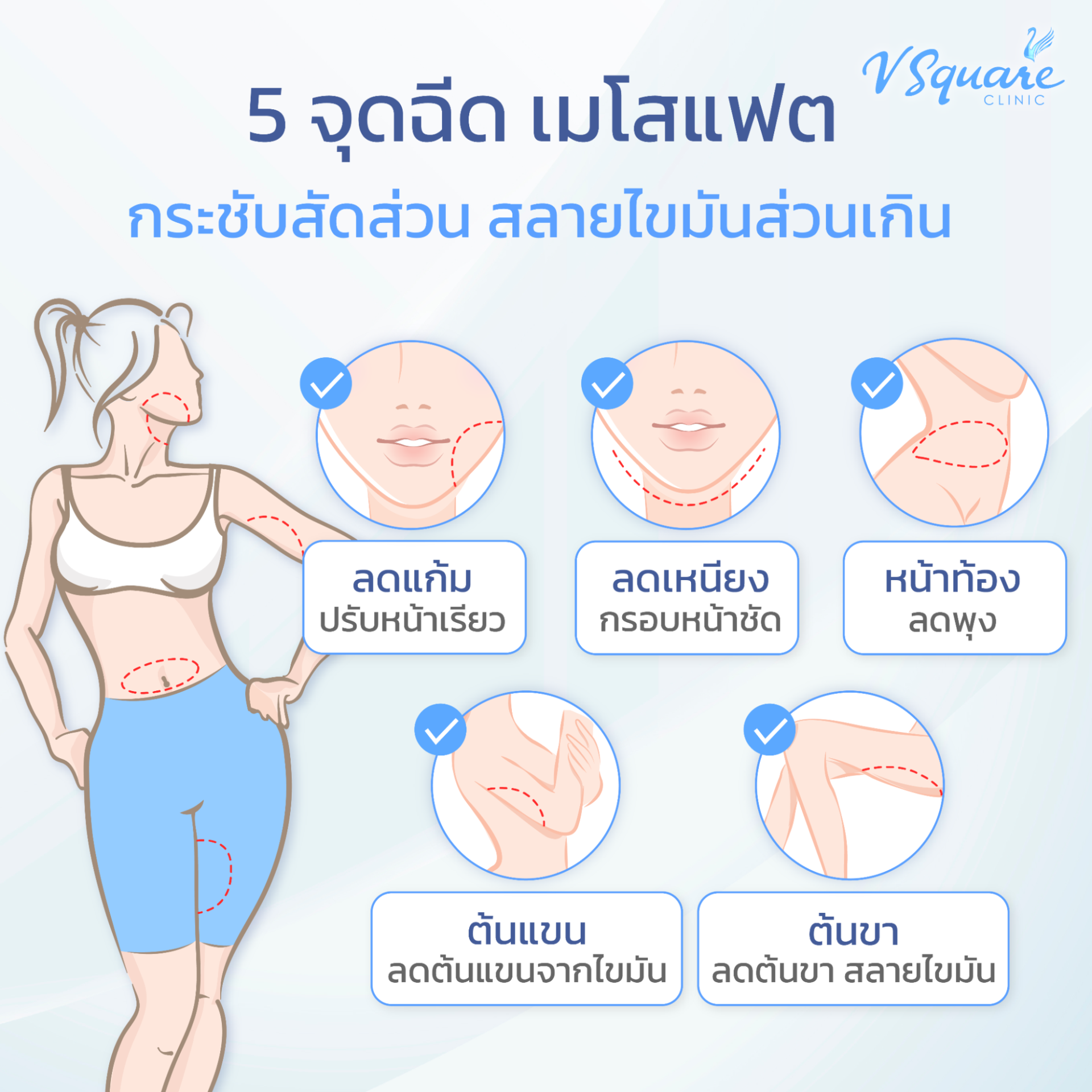 ตำแหน่งฉีดเมโสแฟต
