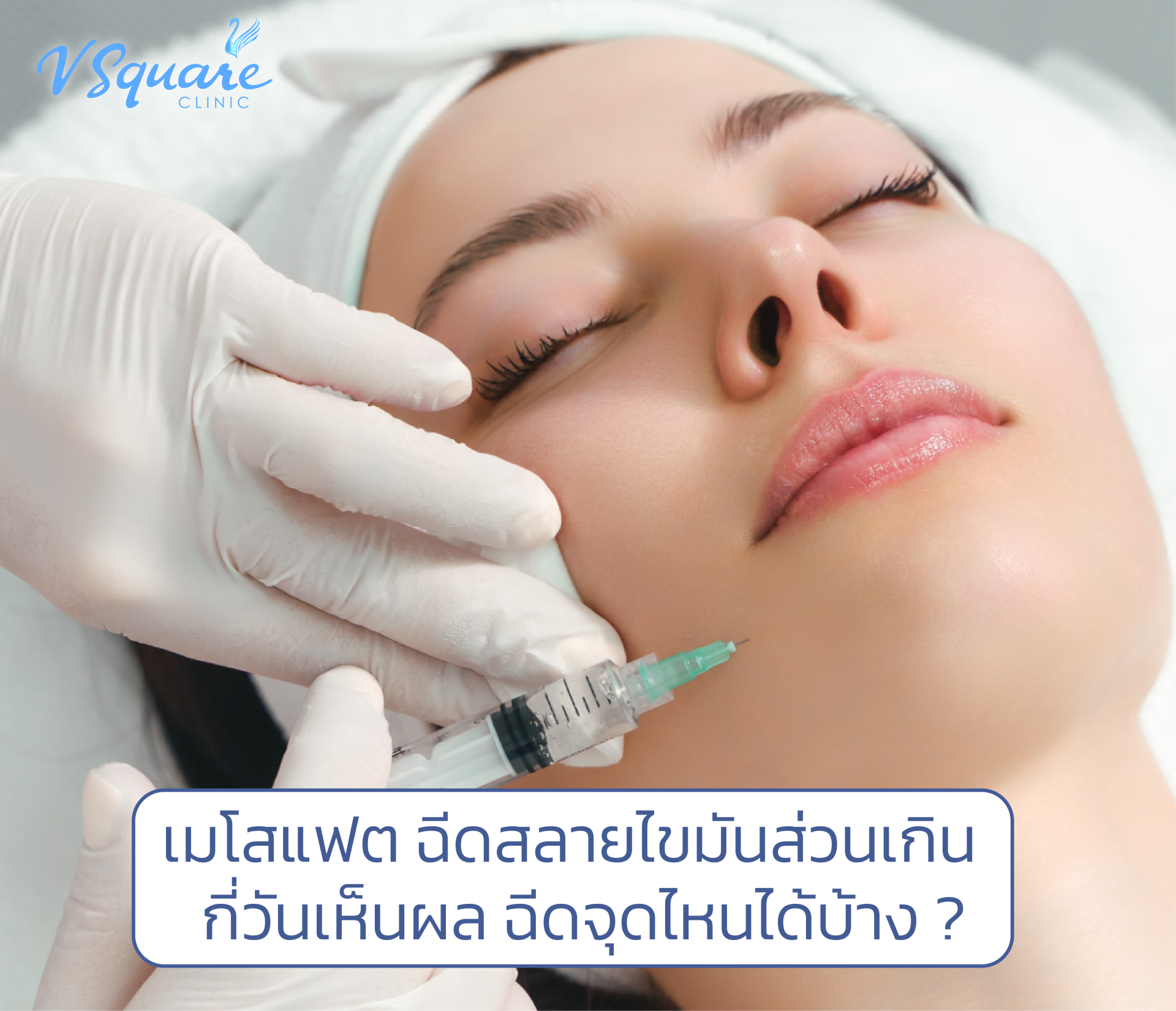 เมโสแฟต(1)
