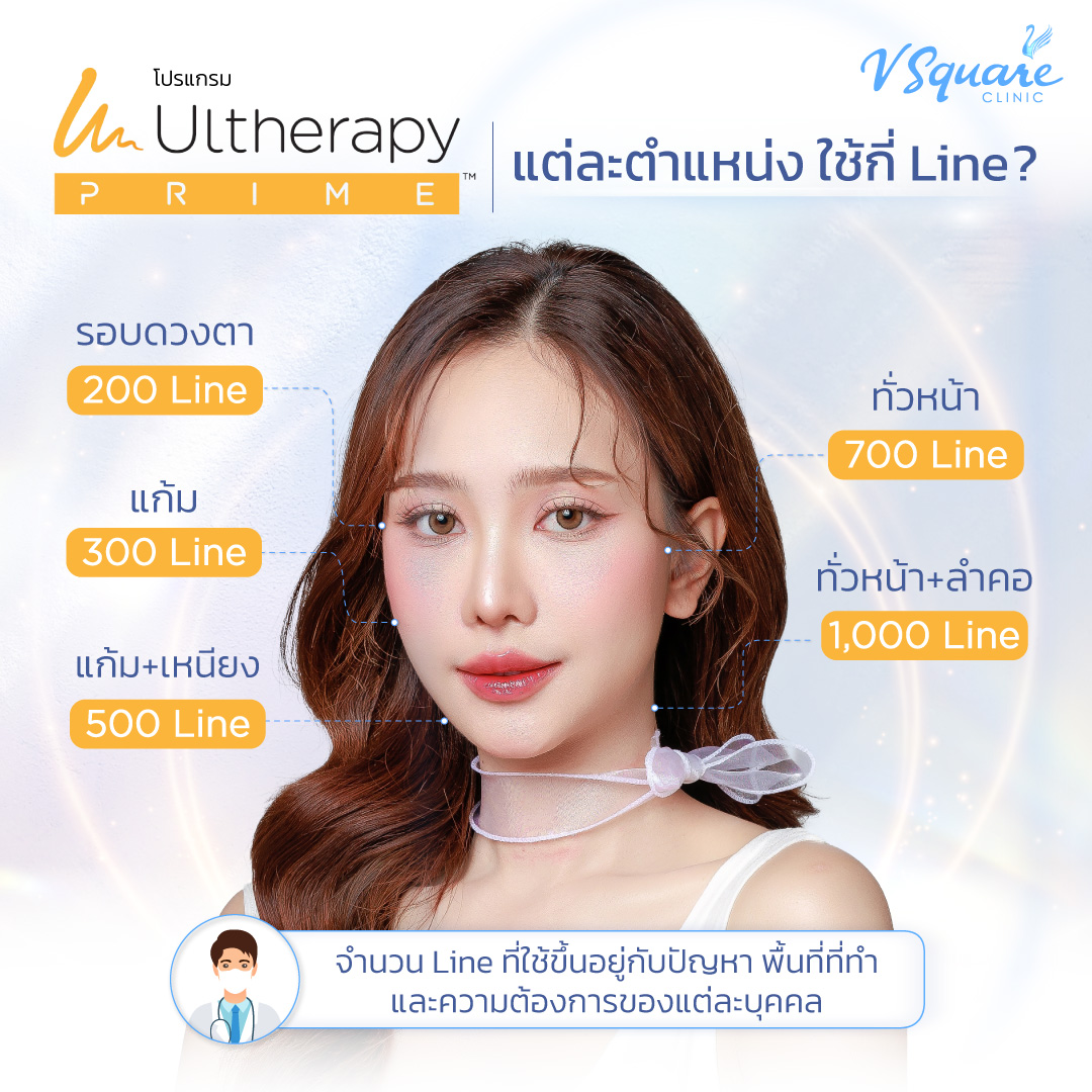 Ulthera ทำกี่ไลน์ ถึงจะเห็นผล