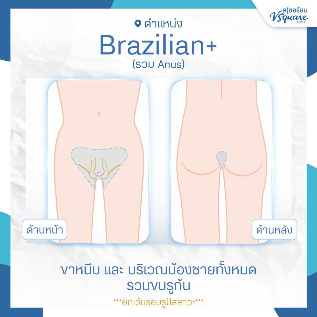 Brazilian Laser ผู้ชาย