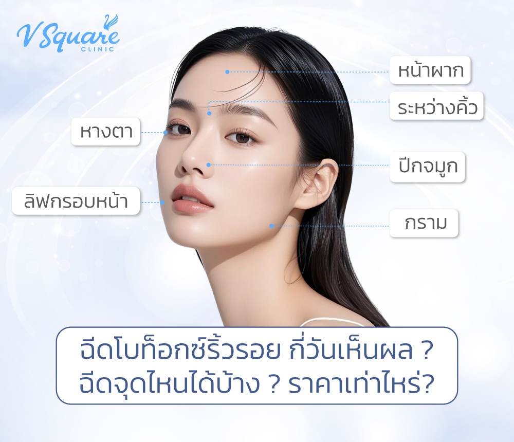 ฉีดโบท็อกซ์ลดริ้รอย-กี่วันเห็นผล-ฉีดจุดไหน