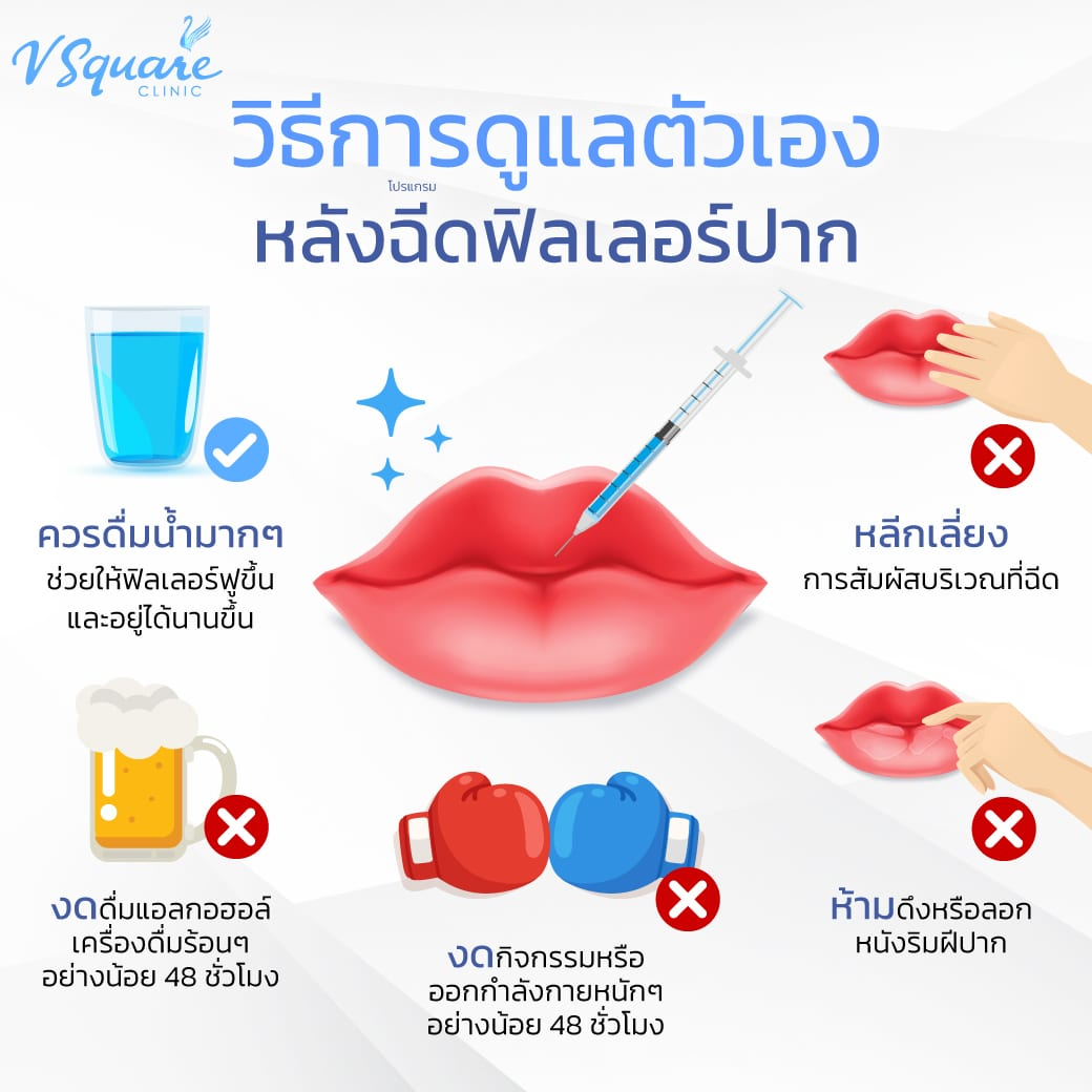 หลังฉีดฟิลเลอร์ปาก