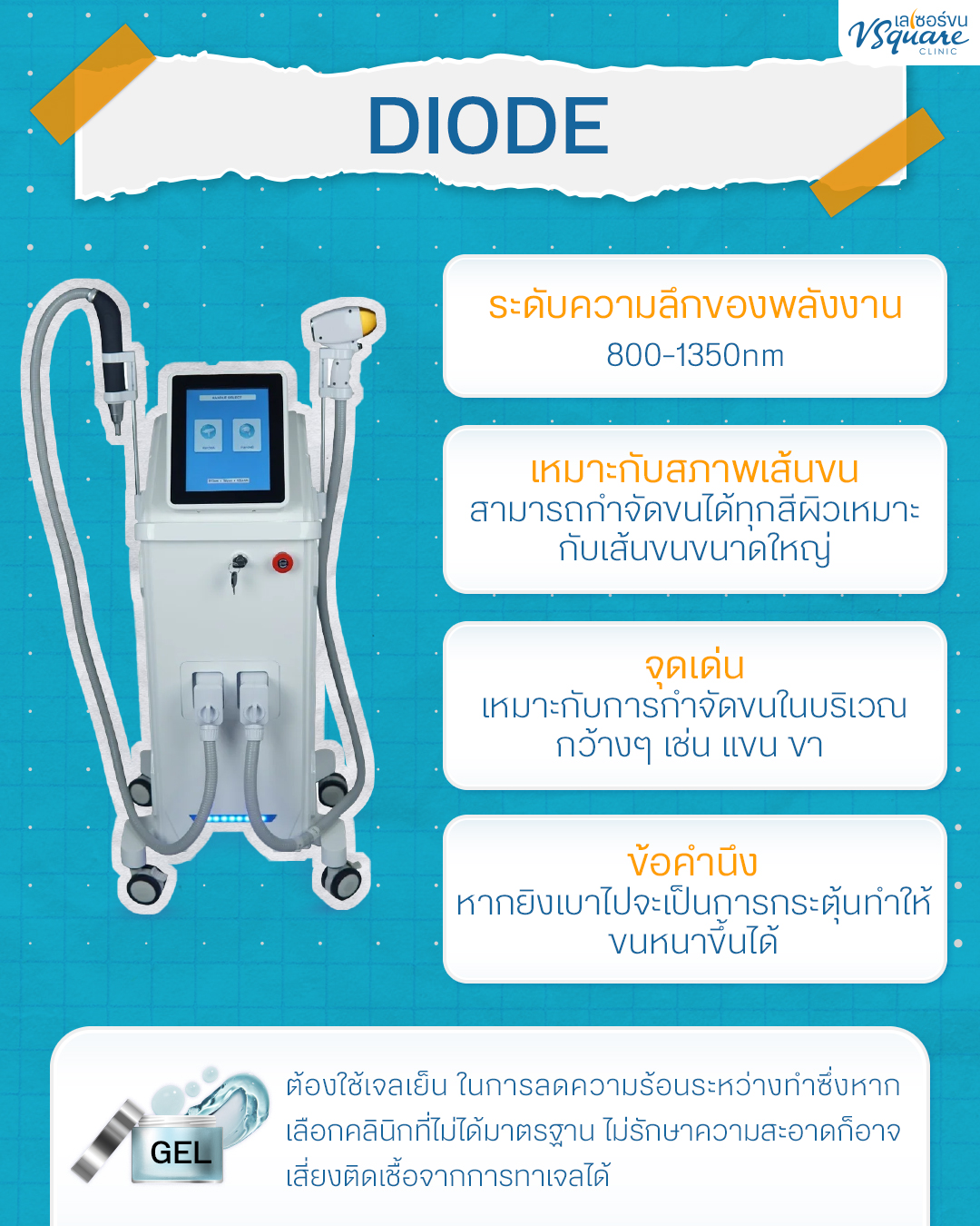 Diode Laser คืออะไร