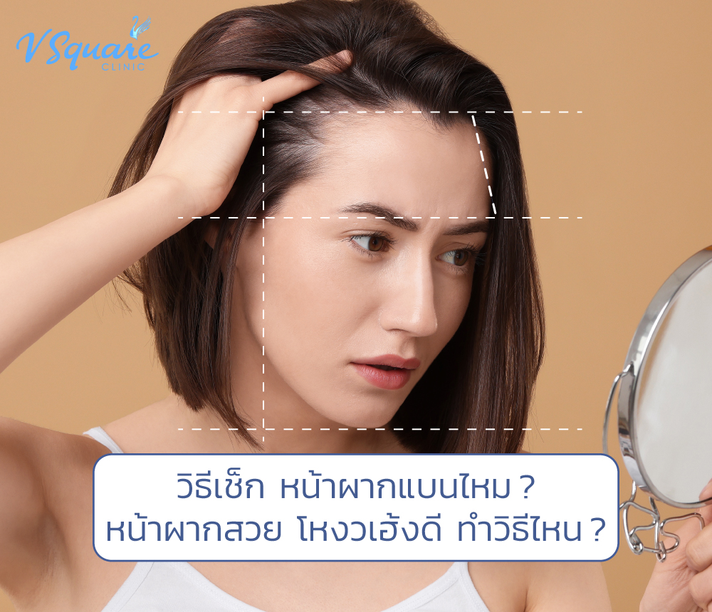 หน้าผากแบน