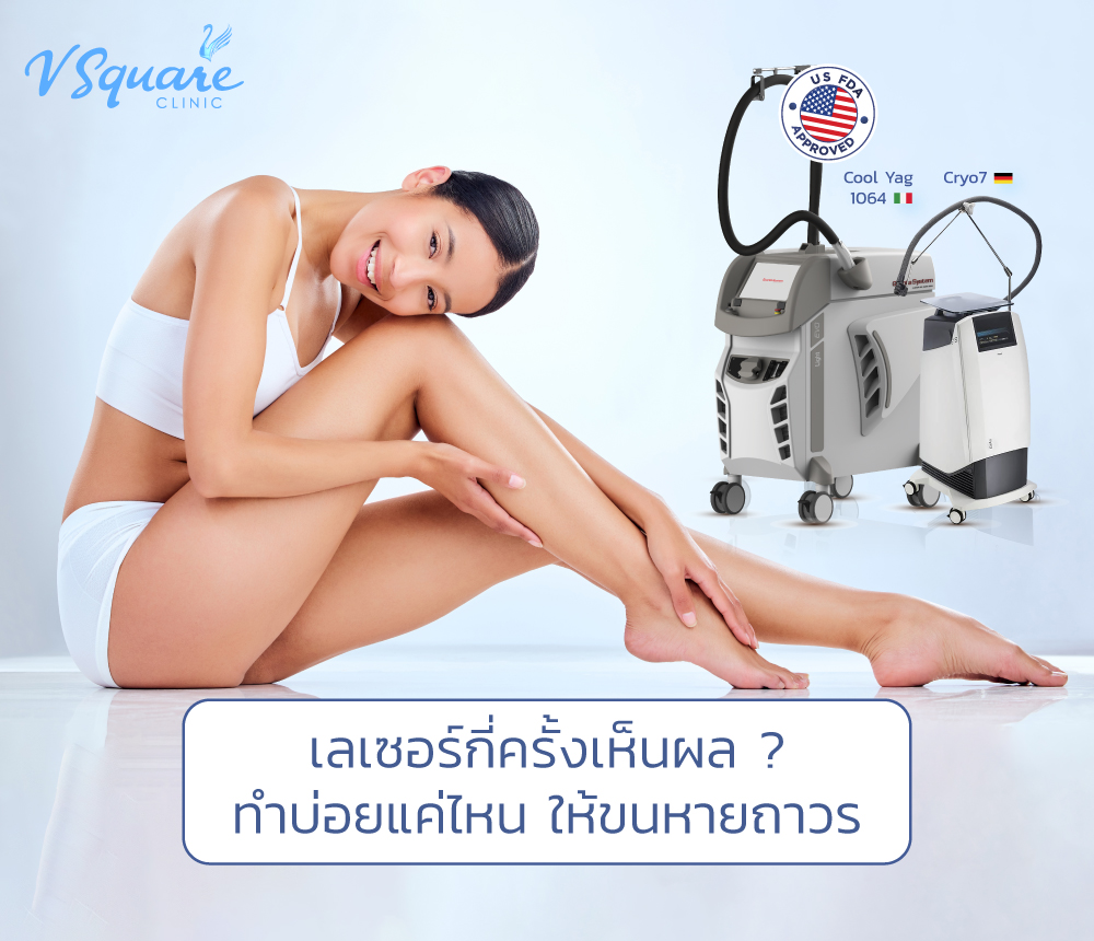 เลเซอร์กี่ครั้งเห็นผล