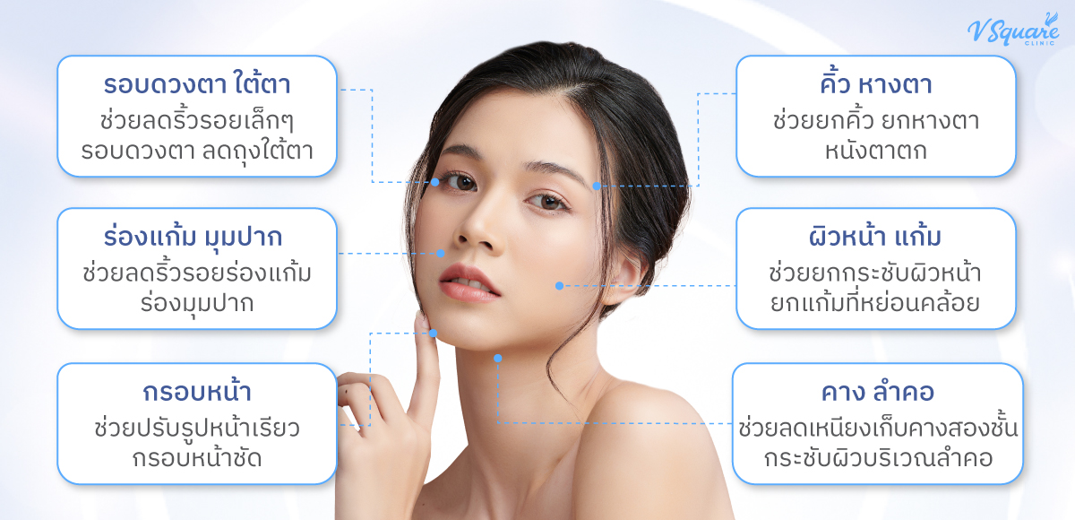Hifu-ทำตำแหน่งไหนได้บ้าง