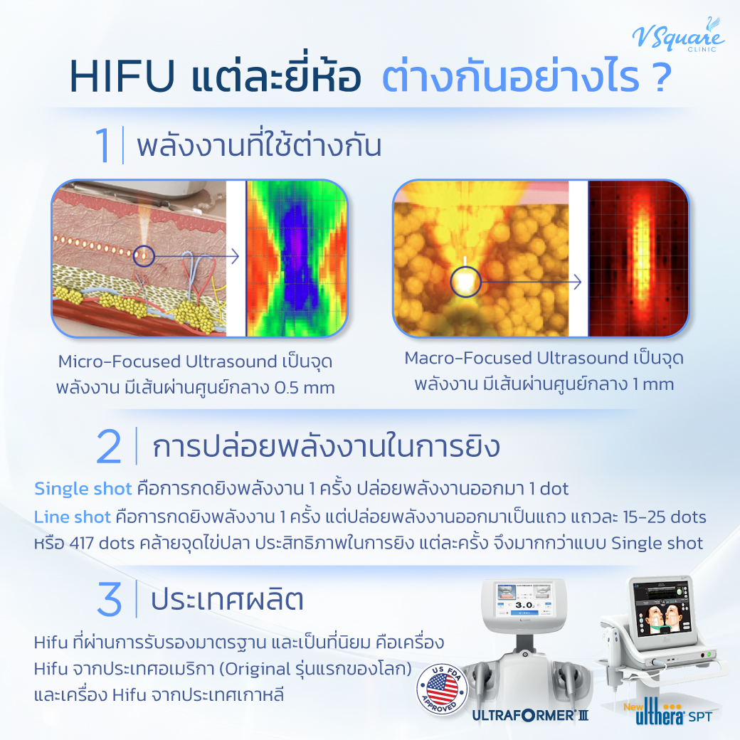 Hifu แต่ละยี่ห้อ ต่างกันอย่างไร